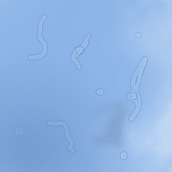 Floaters