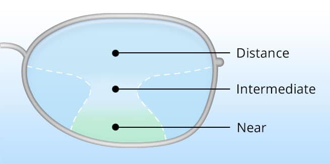 Presbyopia Treatment