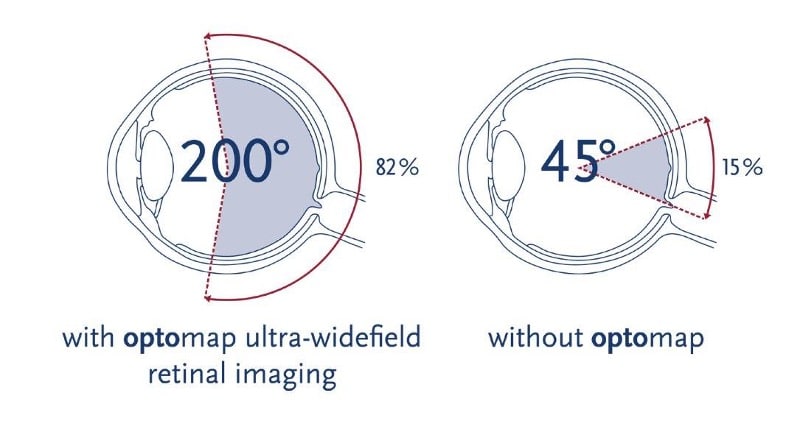 Retinal Image Comparison