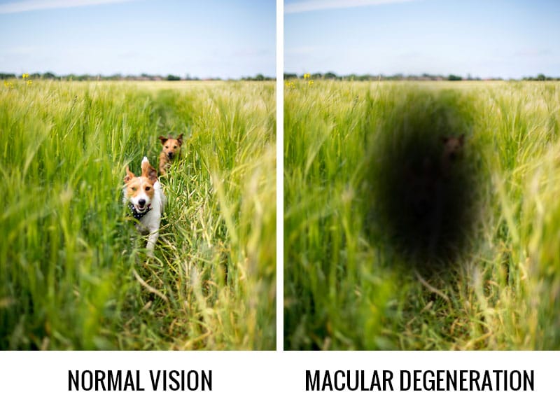 Changes in your eyes after age 40: Macular Degeneration