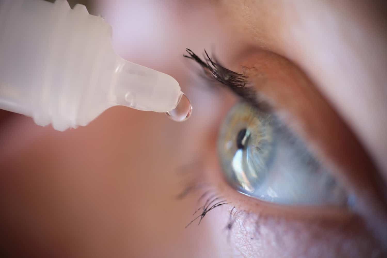Woman dripping eye drop into her eyes